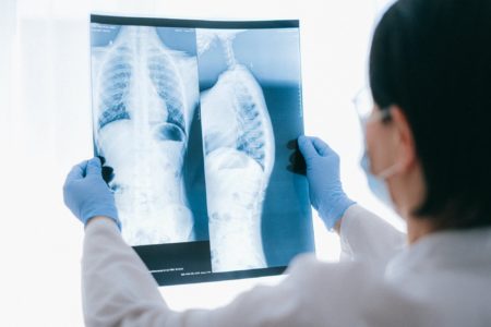 L’IA est aussi efficace qu’un médecin pour analyser les radiographies pulmonaires AI is just as good as a doctor at analyzing chest X-rays