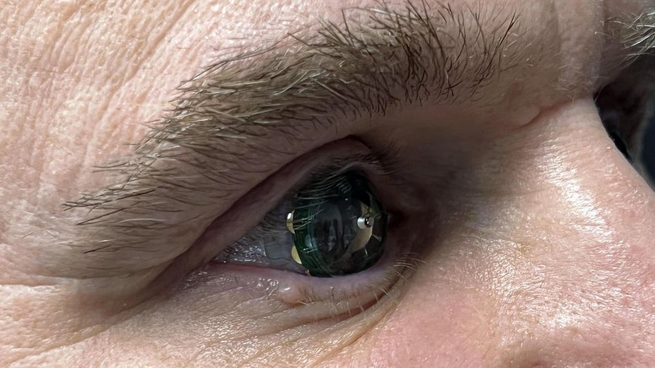 Mojo Lens : lentille de contact AR testée avec succès