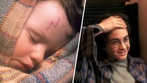 Harry Potter fans finally learn why his scar is shaped like a lightning bolt